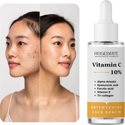 RoseBrite Skin Rejuvenation Face Serum – Infused with Vitamin C to Brighten, Hydrate and Restore Natural Glow to Tired, Uneven Skin
