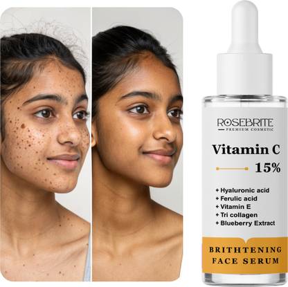 RoseBrite Glow Boost Vitamin C Serum – With Vitamin E, Hyaluronic Acid & Ferulic Acid to Hydrate, Brighten & Smooth Skin