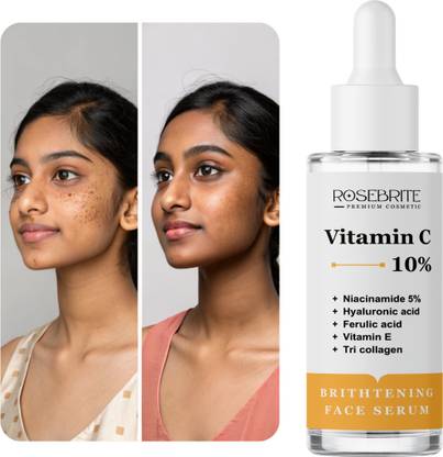 RoseBrite Glowing Skin Serum – Vitamin C Rich Formula to Combat Hyperpigmentation & Dullness with Ease