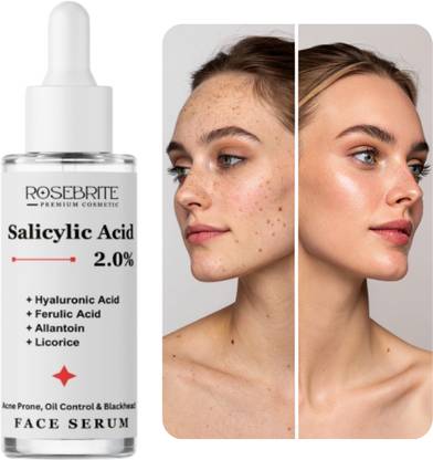 RoseBrite Gentle Exfoliating Salicylic Acid Serum – Hyaluronic & Ferulic Acid Blend Clears Dullness, Smooths Texture, Brightens