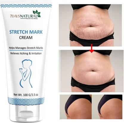 7days natural Say Goodbye to Stretch Marks with our Stretch Marks Cream Reduce� Scars