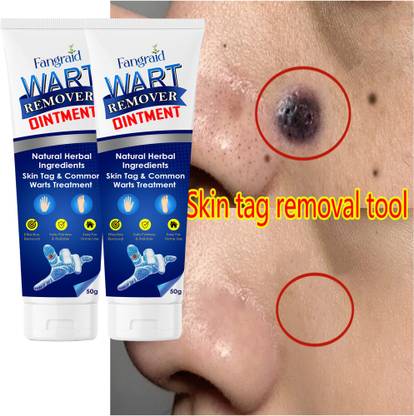 UPASTHIT Wart remover ointment cream for all Natural wart removal