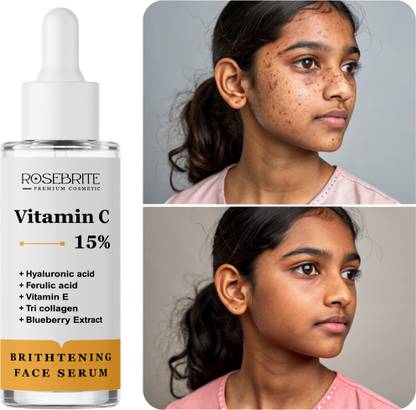 RoseBrite Bright & Plump Face Serum – With Vitamin C and Hyaluronic Acid to Brighten Skin, Reduce Spots & Smooth Fine Lines