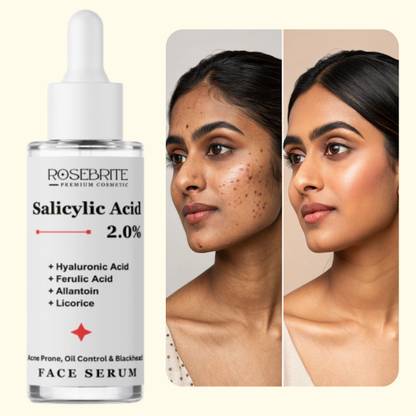 RoseBrite Skin Brightening Serum with Salicylic Acid, Hyaluronic Acid, Ferulic Acid, Allantoin & Licorice | Clearer Even Skin