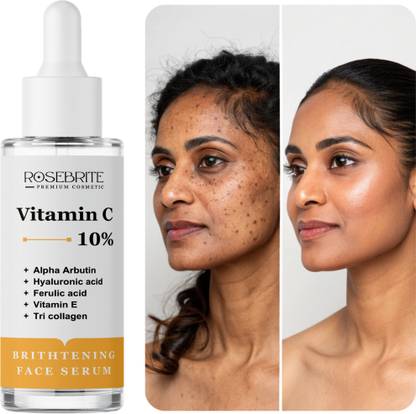 RoseBrite Anti-Dark Spot Vitamin C Serum – Visibly Fades Pigmentation & Revives Dull Complexion for Even, Glowing Skin Tone