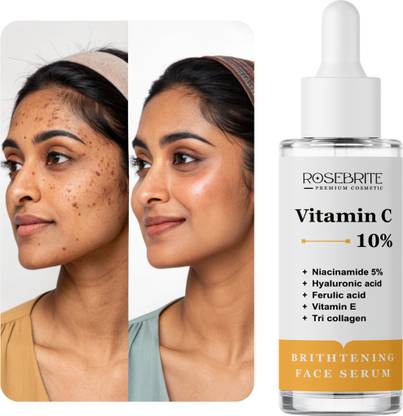 RoseBrite Brightening Serum for Face – Vitamin C + Niacinamide to Improve Tone, Clarity & Texture