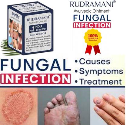 Rudramani For Eczema Ringworm, Itches cold Cracks and pimples cream Skin Infection-Pack-1
