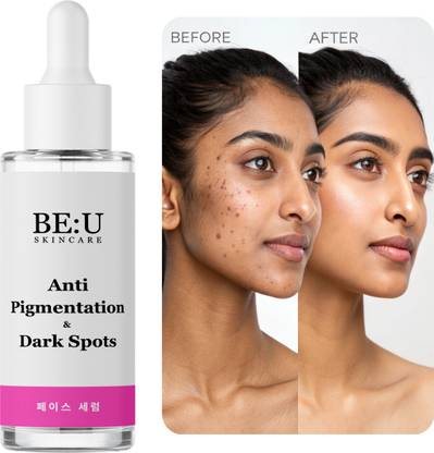 Be U Vitamin C Serum for Dark Spots & Hyperpigmentation – With Niacinamide, Alpha Arbutin for Spotless, Radiant, Even Skin Tone