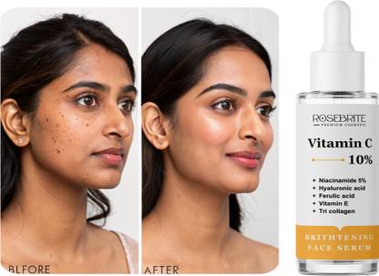 RoseBrite Silky Skin Serum – Vitamin C Reduces Lines & Adds Elasticity