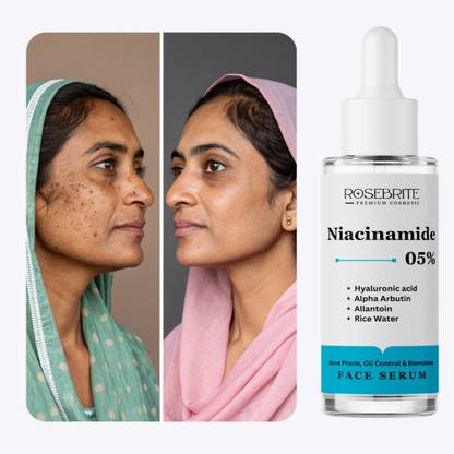 RoseBrite Radiance Boost Face Serum – Refines Pores, Soothes Redness & Balances Sebum for a Smooth, Clear Glow