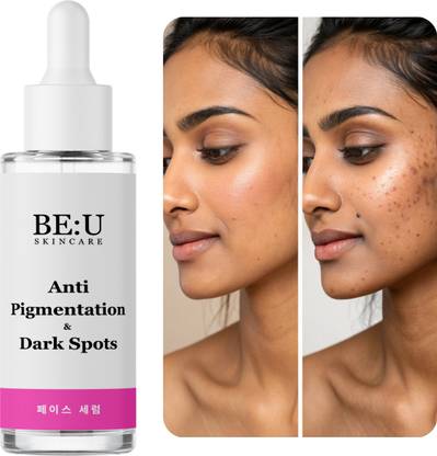 Be U Vitamin C Niacinamide Face Serum – Brightening & Anti Pigmentation Serum for Dark Spot Removal & Glowing Complexion