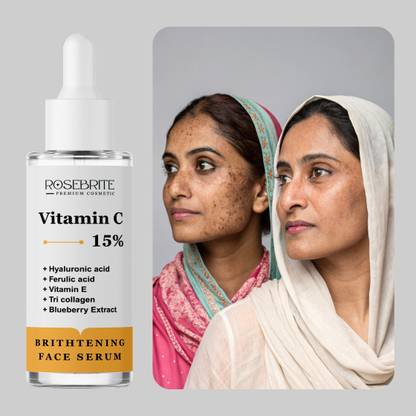 RoseBrite Vitamin C Face Serum – Brightens Skin, Evens Tone, Reduces Pigmentation & Dullness Daily