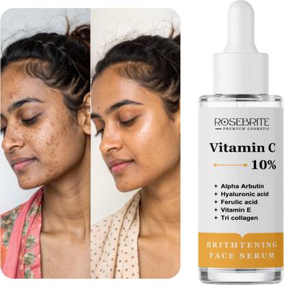 RoseBrite Clinical Brightening Serum – Vitamin C Formula with Dermatologist Backing for Dark Spots & Fine Lines