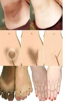EVERERIN Bikini Skin Whitening And Darkness Reduction Cream For All Skin Type