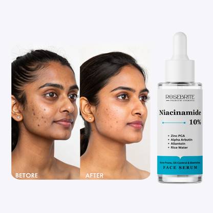 RoseBrite Niacinamide + Zinc PCA Acne Control Serum – Reduces Excess Oil, Fades Marks, Tightens Pores, and Brightens Skin Tone