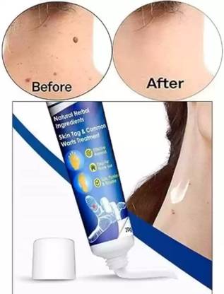 FUSION FLY wart face cream 2