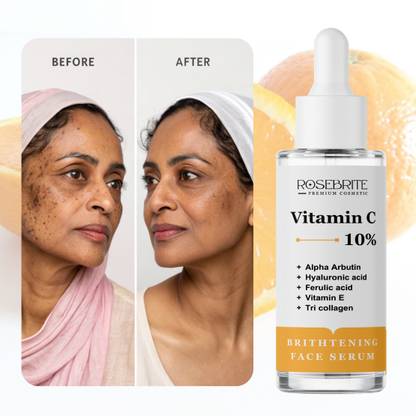 RoseBrite Vitamin C Skin Glow Serum – Smooths Rough Skin, Reduces Redness & Brightens for Healthy Radiance