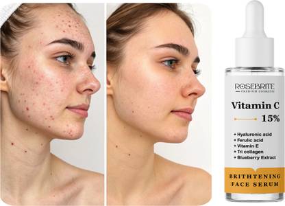 RoseBrite 15% Vitamin C Serum for Face – Firms, Hydrates & Brightens Skin with Ferulic Acid, Vitamin E & Hyaluronic Acid for Anti-Aging Support