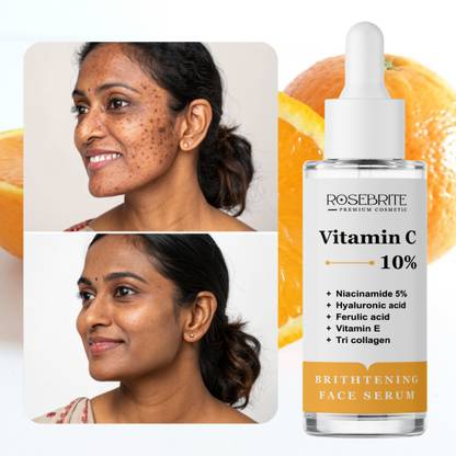 RoseBrite Glow Therapy Face Serum – Vitamin C Hydrates, Smooths & Evens Skin Tone
