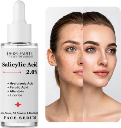 RoseBrite Salicylic Acid, Hyaluronic Acid & Ferulic Acid Serum – Exfoliates Gently, Brightens Dull Skin, Improves Smoothness & Glow