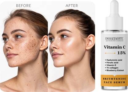 RoseBrite Vitamin C Spot Fading Serum – With Ferulic Acid, Vitamin E & Hyaluronic Acid to Restore Glow & Hydrate Skin