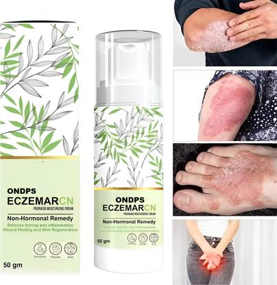 ONDPS New Malam Cream for Anti-Fungal Infection,Itching & Skin Recovery (50 gm)
