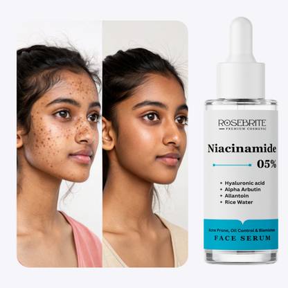 RoseBrite Serum with Niacinamide + Alpha Arbutin + HA – Advanced Formula for Skin Glow, Hydration & Pigmentation Control