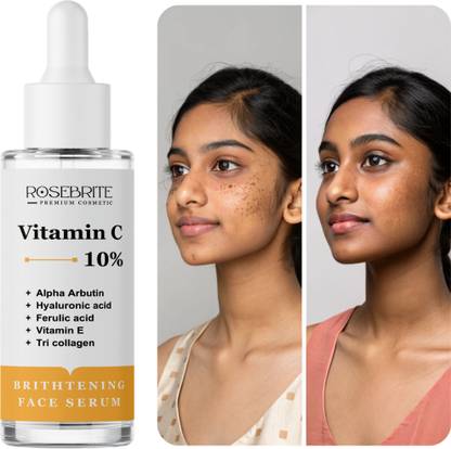 RoseBrite Vitamin C Glow Enhancer – Reduces Dark Spots, Evens Skin & Boosts Natural Clarity