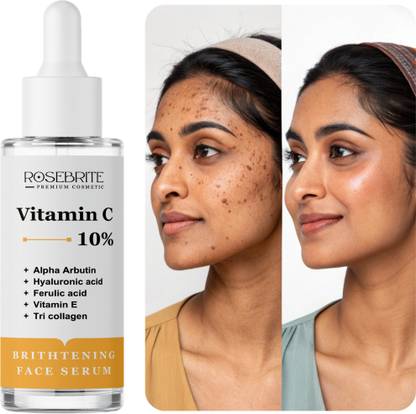 RoseBrite Vitamin C Face Serum – Targets Pigmentation, Dull Skin & Spots to Reveal Brighter, Smoother & More Even-Looking Skin Tone