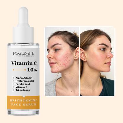 RoseBrite Potent Vitamin C Brightening Serum – Targets Uneven Skin Tone, Dark Spots & Sun Damage for a Flawless, Luminous Glow
