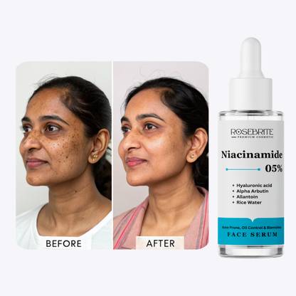 RoseBrite Advanced Hydrating Face Serum for Plumper, Firmer Skin with Visible Fine Line Reduction and Improved Skin Elasticity Over Time