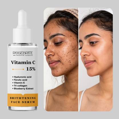 RoseBrite Vitamin C Serum – Skin Brightening, Spot Correction & Daily Glow Boost in One