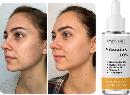 RoseBrite Redness Reducing Vitamin C Serum – Brightens, Clarifies & Regulates Sebum for Balanced, Even-Toned Skin