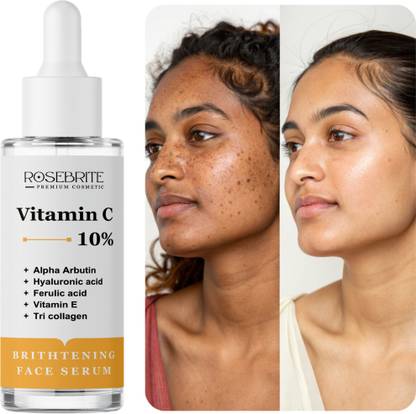 RoseBrite Vitamin C Serum Duo – Day & Night Formula for 24/7 Dark Spot Reduction & Glow Boosting