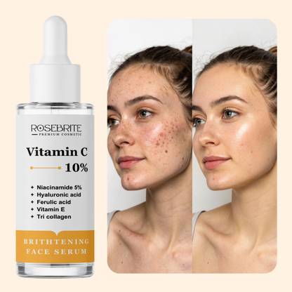RoseBrite Vitamin C Face Serum – Protects From UV, Smog & Dust While Enhancing Skin Clarity