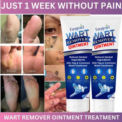 REGLET Wart remover ointment Natural cream for Fast and clean wart Men & Women