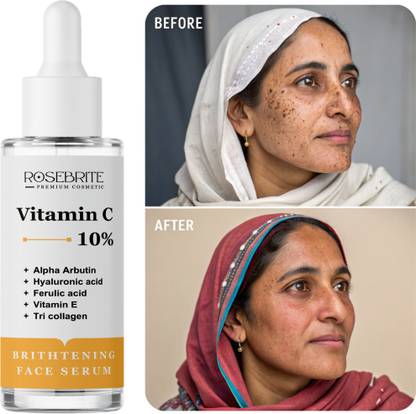 RoseBrite Multi-Benefit & Premium Formulas