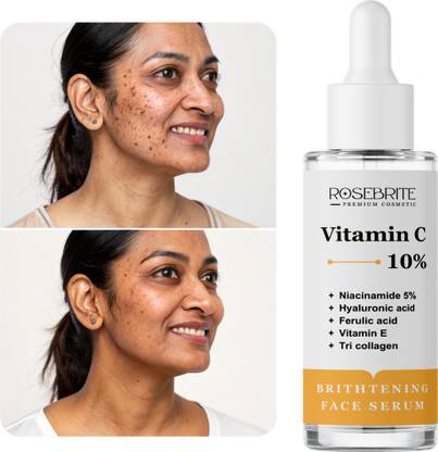 RoseBrite Vitamin C + Niacinamide Glow Serum – For Dull Skin, Uneven Tone & Visible Blemish Repair