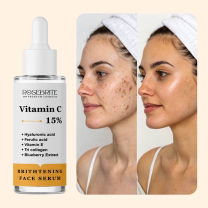 RoseBrite Face Brightening Serum – Vitamin C Formula for Glowing, Even Skin Tone