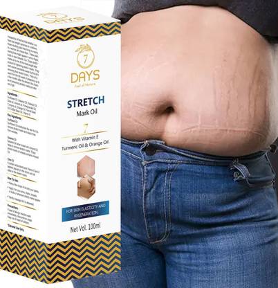 7 Days How to remove stretch marks permanently