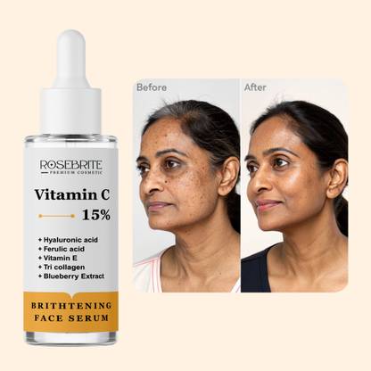 RoseBrite Vitamin C Face Serum – Deep Hydration & Tone Correction with Ferulic Acid, Vitamin E & Hyaluronic Acid