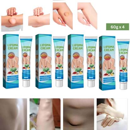 SIYDHA Lumpfree Lipoma Removal Cream Organic Gaanth Removal Ointment 60gx4