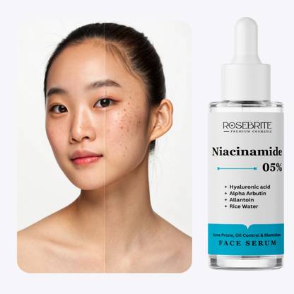 RoseBrite Anti-Oil & Redness Serum – Repairs Skin, Clears Pores & Calms Flare-Ups Without Harsh Additives