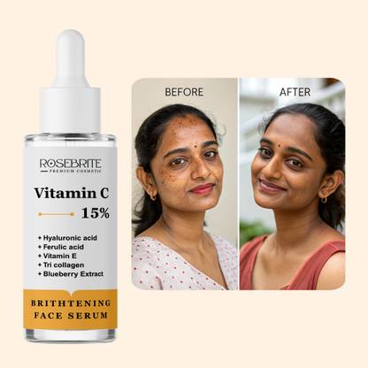 RoseBrite Pigmentation Removal Face Serum – Enriched with Vitamin C, Hyaluronic Acid, Ferulic Acid & Vitamin E for Clearer, Even-Toned, Radiant Skin