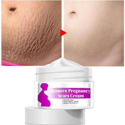 GULGLOW99 Perfect For All Pregnant Lady Use Scar Removal Cream