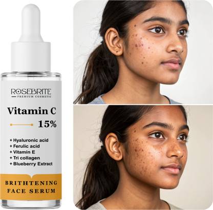 RoseBrite Sun Damage Defense Vitamin C Serum – Hydrates, Brightens & Shields Skin with Ferulic Acid, Vitamin E & Hyaluronic Acid Power Complex