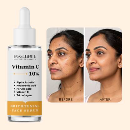 RoseBrite Professional-Grade Vitamin C Serum – Reduces Post-Acne Marks, Sun Damage & Age Spots for a Brighter, Youthful Complexion