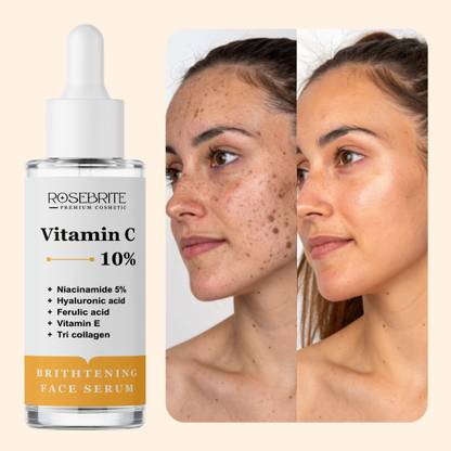 RoseBrite Anti-Pollution Vitamin C Serum – Boosts Glow, Fights Toxins & Supports Radiance