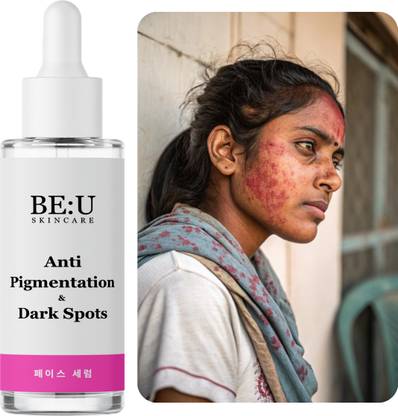 Be U Anti Pigmentation & Dark Spots Face Serum with Vitamin C & Niacinamide for Glowing, Even Skin Tone – Brightening Serum for All Skin Types