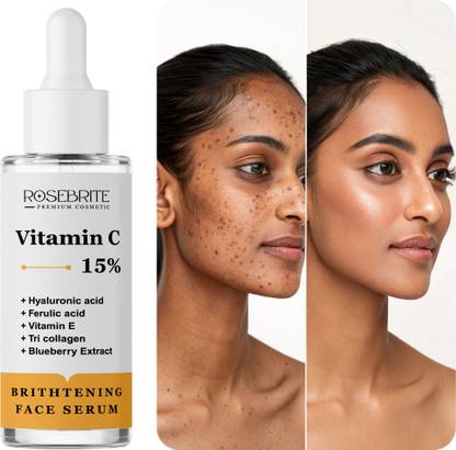RoseBrite Vitamin C Face Serum – Daily Brightening Formula That Reduces Dullness, Spots & Fine Lines